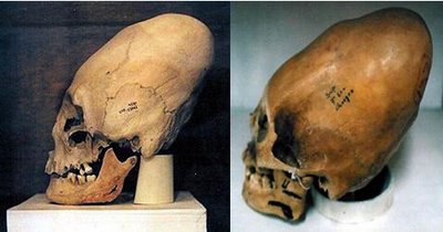 Alien Elongated Skulls?